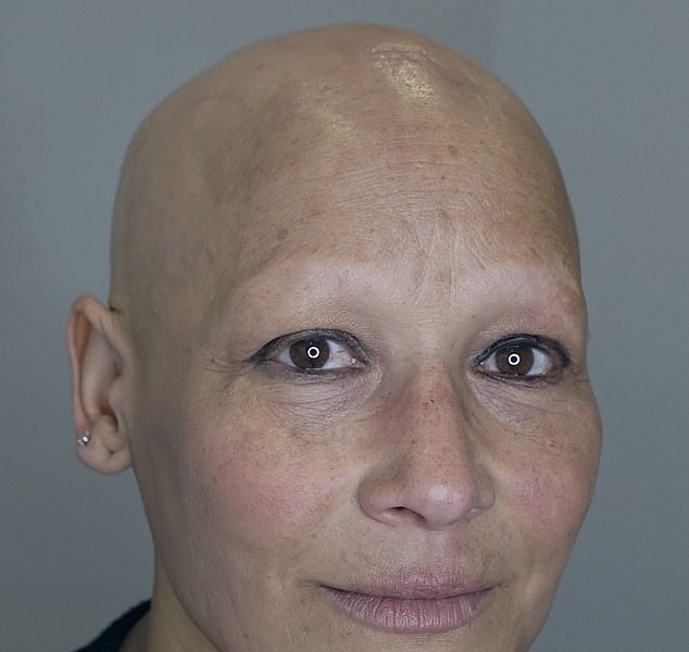 Woman with no eyebrows