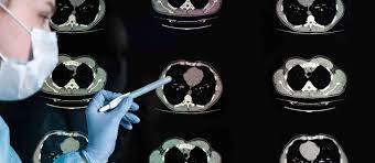 “High-Quality CT Scans Available in Farmington for Accurate Medical Diagnoses”